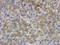 Collagen Type X Alpha 1 Chain antibody, orb10444, Biorbyt, Immunohistochemistry paraffin image 