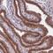 Coiled-Coil Domain Containing 113 antibody, HPA040869, Atlas Antibodies, Immunohistochemistry paraffin image 