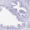 Placenta Enriched 1 antibody, HPA063425, Atlas Antibodies, Immunohistochemistry frozen image 