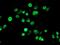 Sentrin-specific protease 2 antibody, MA5-25987, Invitrogen Antibodies, Immunocytochemistry image 