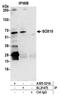 SRY-Box 10 antibody, A305-521A, Bethyl Labs, Immunoprecipitation image 