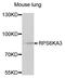 Ribosomal Protein S6 Kinase A3 antibody, STJ27389, St John