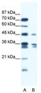 Zinc Finger Protein 577 antibody, TA341419, Origene, Western Blot image 