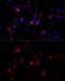 Filamin C antibody, GTX66151, GeneTex, Immunofluorescence image 