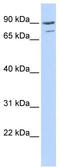 A-Kinase Anchoring Protein 8 antibody, TA331143, Origene, Western Blot image 