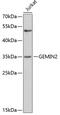 Survival of motor neuron protein-interacting protein 1 antibody, GTX33217, GeneTex, Western Blot image 