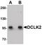 Doublecortin Like Kinase 2 antibody, PA5-20910, Invitrogen Antibodies, Western Blot image 