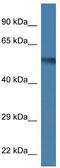 UDP-N-Acetylglucosamine Pyrophosphorylase 1 antibody, TA331026, Origene, Western Blot image 