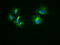 Keratin 18 antibody, TA500015, Origene, Immunofluorescence image 