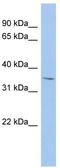 Mercaptopyruvate Sulfurtransferase antibody, TA346634, Origene, Western Blot image 