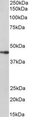 NPHS2 Stomatin Family Member, Podocin antibody, 43-360, ProSci, Western Blot image 