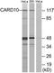 Caspase Recruitment Domain Family Member 10 antibody, TA312727, Origene, Western Blot image 
