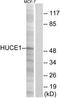 Ribosomal RNA-processing protein 8 antibody, TA315242, Origene, Western Blot image 