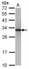Proteasome Activator Subunit 1 antibody, NBP2-19992, Novus Biologicals, Western Blot image 