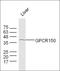 Ghrelin And Obestatin Prepropeptide antibody, orb183806, Biorbyt, Western Blot image 