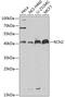 Reticulocalbin 2 antibody, GTX32836, GeneTex, Western Blot image 