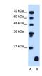 PLP2 antibody, NBP1-62539, Novus Biologicals, Western Blot image 