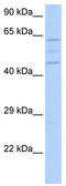 VPS37A Subunit Of ESCRT-I antibody, TA338843, Origene, Western Blot image 