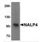NLR Family Pyrin Domain Containing 4 antibody, MBS150202, MyBioSource, Western Blot image 