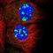 CXXC Finger Protein 5 antibody, NBP1-81675, Novus Biologicals, Immunocytochemistry image 