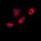 Disabled homolog 1 antibody, orb213836, Biorbyt, Immunofluorescence image 