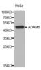 Putative disintegrin and metalloproteinase domain-containing protein 5 antibody, abx004733, Abbexa, Western Blot image 