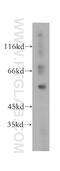 Nucleolar Complex Associated 4 Homolog antibody, 17025-1-AP, Proteintech Group, Western Blot image 