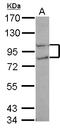 RNA polymerase II subunit A C-terminal domain phosphatase antibody, LS-C155400, Lifespan Biosciences, Western Blot image 