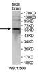 Zinc Finger Protein 512 antibody, orb78122, Biorbyt, Western Blot image 