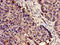 Plasma serine protease inhibitor antibody, orb401232, Biorbyt, Immunohistochemistry paraffin image 