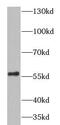 Hexosaminidase Subunit Alpha antibody, FNab03842, FineTest, Western Blot image 