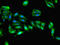 Dihydrofolate Reductase antibody, LS-C369534, Lifespan Biosciences, Immunofluorescence image 