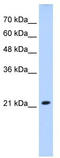 Brain mitochondrial carrier protein 1 antibody, TA333986, Origene, Western Blot image 