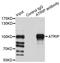 ATR-interacting protein antibody, STJ29219, St John