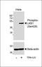 Serine/Threonine Kinase 11 antibody, M00217-1, Boster Biological Technology, Western Blot image 