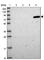 Propionyl-CoA Carboxylase Subunit Alpha antibody, HPA047792, Atlas Antibodies, Western Blot image 