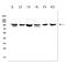 Discoidin Domain Receptor Tyrosine Kinase 1 antibody, A00905, Boster Biological Technology, Western Blot image 