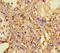 2-5A-dependent ribonuclease antibody, A55090-100, Epigentek, Immunohistochemistry paraffin image 