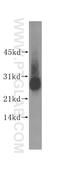 Ubiquitin C-Terminal Hydrolase L1 antibody, 14730-1-AP, Proteintech Group, Western Blot image 