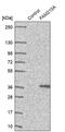 Family With Sequence Similarity 210 Member A antibody, PA5-62434, Invitrogen Antibodies, Western Blot image 
