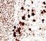 Ubiquitin C-Terminal Hydrolase L1 antibody, V2293IHC-7ML, NSJ Bioreagents, Immunohistochemistry frozen image 
