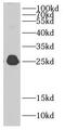 Chromobox 1 antibody, FNab01328, FineTest, Western Blot image 