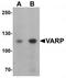 Ankyrin Repeat Domain 27 antibody, TA320041, Origene, Western Blot image 