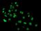 Phosphodiesterase 4B antibody, MA5-25677, Invitrogen Antibodies, Immunocytochemistry image 