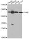 Phosphorylase Kinase Regulatory Subunit Beta antibody, A8015, ABclonal Technology, Western Blot image 