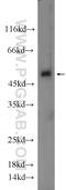BEN Domain Containing 5 antibody, 20931-1-AP, Proteintech Group, Western Blot image 