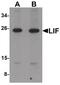 LIF Interleukin 6 Family Cytokine antibody, PA5-21122, Invitrogen Antibodies, Western Blot image 