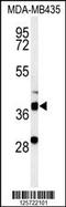 Dehydrogenase/Reductase 7 antibody, 61-656, ProSci, Western Blot image 