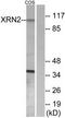 5'-3' Exoribonuclease 2 antibody, TA315179, Origene, Western Blot image 