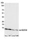 NADH:Ubiquinone Oxidoreductase Subunit A5 antibody, A305-463A, Bethyl Labs, Western Blot image 
